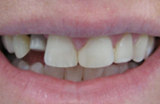 before-2